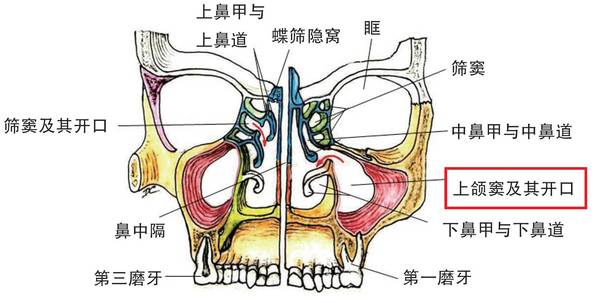 口腔各科治疗中的上颌窦风险 基于cbct研究 健康频道 手机搜狐