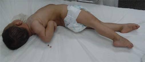 孩子出现 角弓反张 症状应该如何治疗 健康频道 手机搜狐