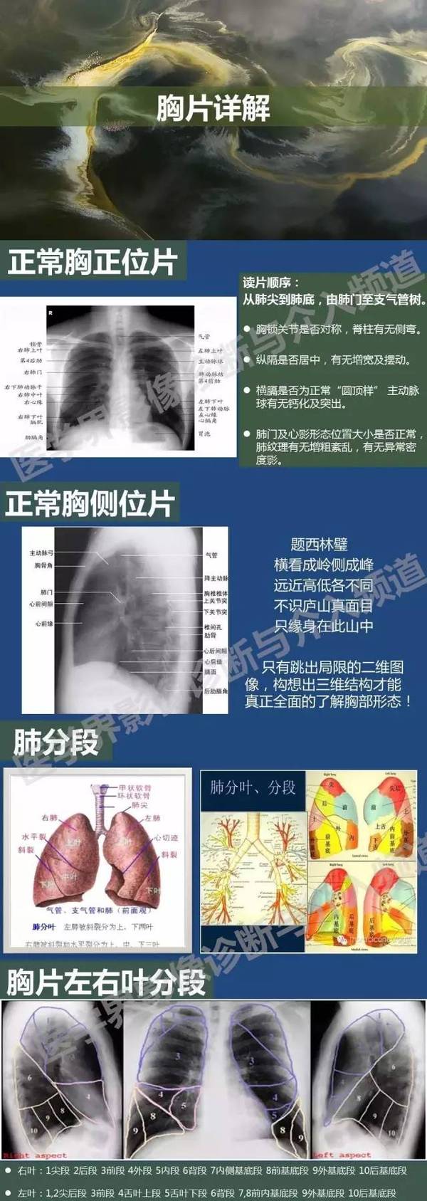 胸片部位图解图片