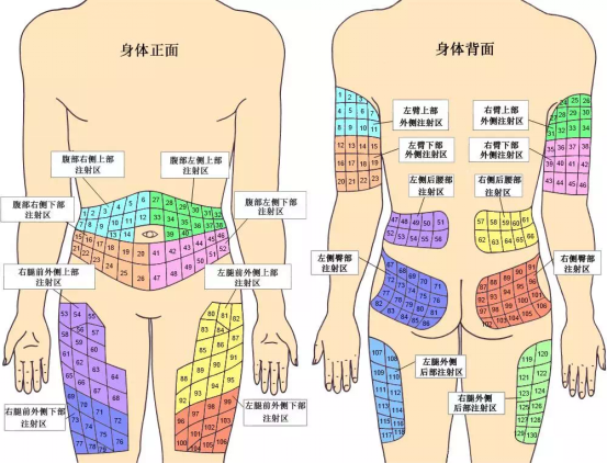 糖友胰岛素的注射部位 值得收藏 健康频道 手机搜狐