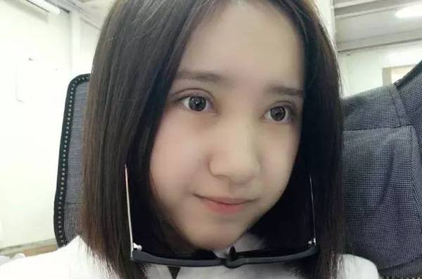 双眼皮术后7天全记录,拆线后秒变二次元萌妹!