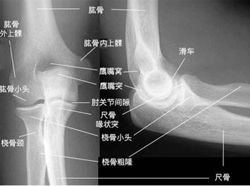 肘关节滑膜炎的表现症状有哪些 有知道的吗 健康频道 手机搜狐