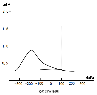 【验配专栏】轻松看懂几种鼓室导抗图的分型