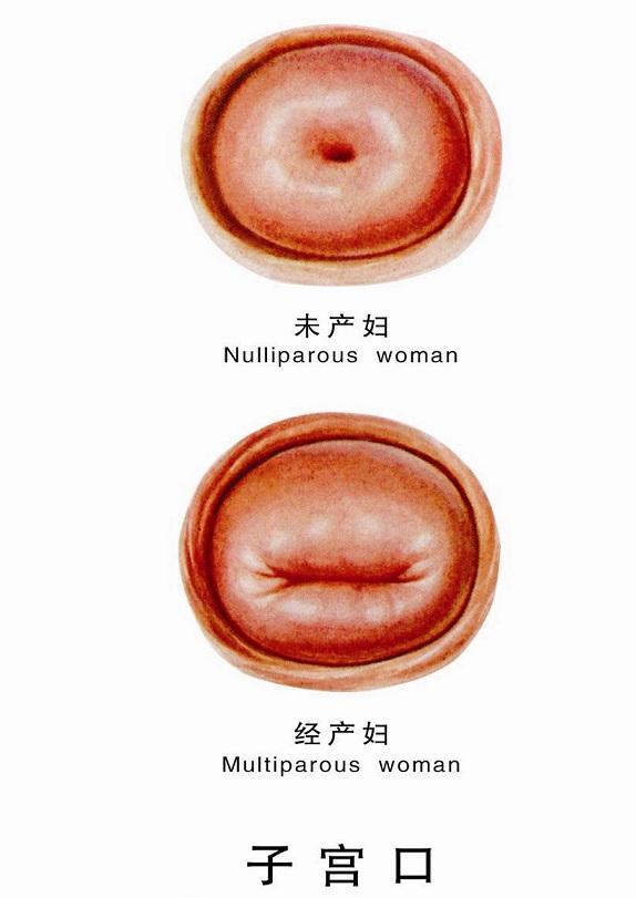 做过人流的宫颈口图片