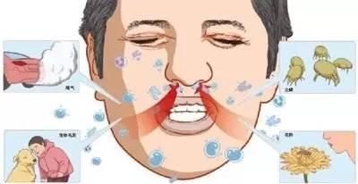 日本什么鼻炎药好 日本鼻炎药大盘点 新闻频道 手机搜狐