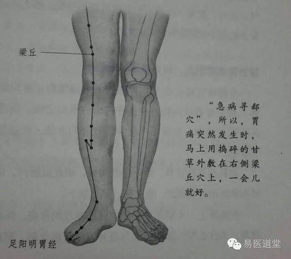 医日一方 急 慢性胃痛的外治祛根法 健康频道 手机搜狐