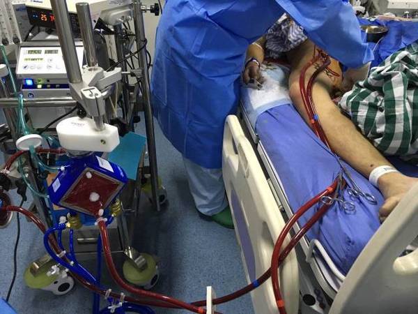 生死之间连着一台ecmo,世界心脏病日:健康的心