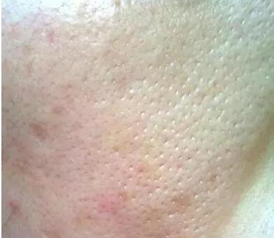 难怪你成橘子皮!