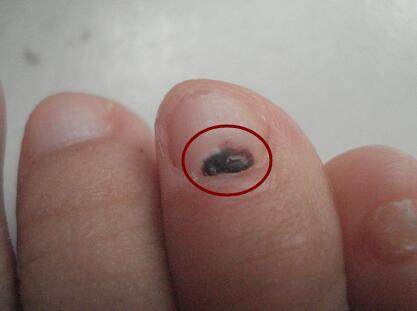 脚上出现这种情况一定要注意 有可能会要了你的命 健康频道 手机搜狐