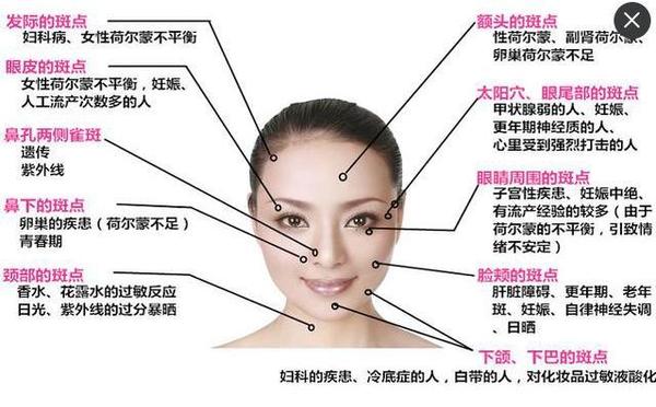 小广老师 你为什么会长斑点 你长的是什么斑点 时尚频道 手机搜狐