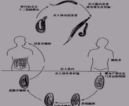 蛲虫出来的产卵的图片图片