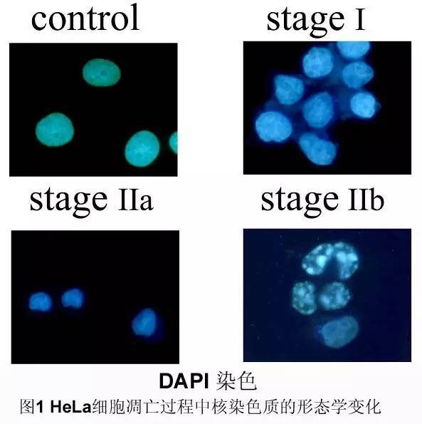 献给初学者 常用的细胞凋亡检测方法 科技频道 手机搜狐
