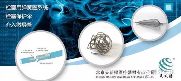 【天新福-神经介入专栏】| 开颅夹闭弹簧圈栓塞