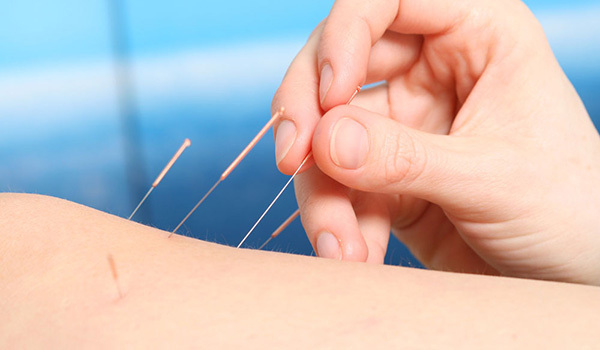 针灸减肥真的有效吗