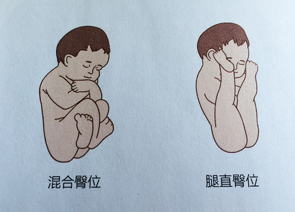 需要注意的是:胎儿一般都会自行转换胎位,如果胎位不正,需要纠正的话