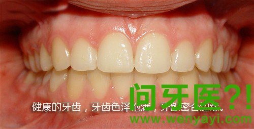 洗牙真的不好吗 牙医骗你了吗 健康频道 手机搜狐