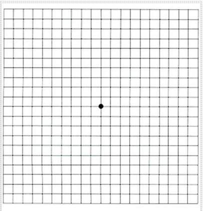 中日医院眼科陈宜:一张表格教你自测"老年性黄斑病变"