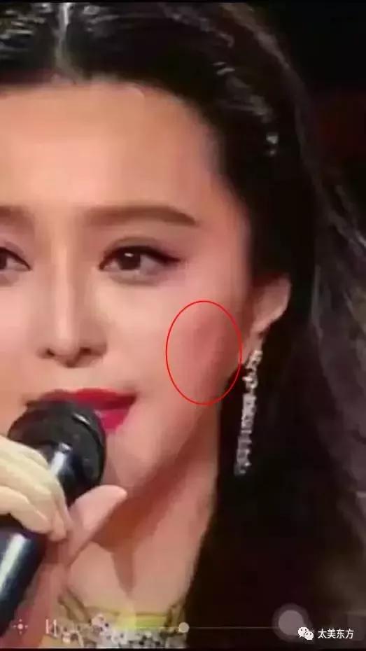 高圆圆老态毕现?赶紧尝试下众女星用的线雕吧