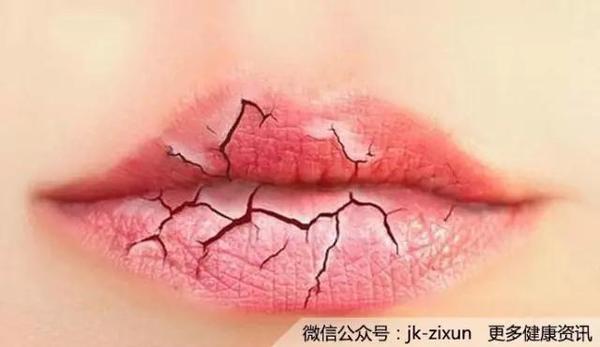 唇膏涂了水也喝了 为什么嘴唇还是跟地面裂缝似的 健康频道 手机搜狐 唇膏涂了水也喝了 为什么嘴唇还是跟地面裂缝似的 健康频道 手机搜狐