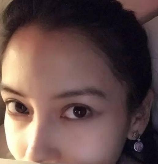 来看看美女明星都是怎么祛痘的吧