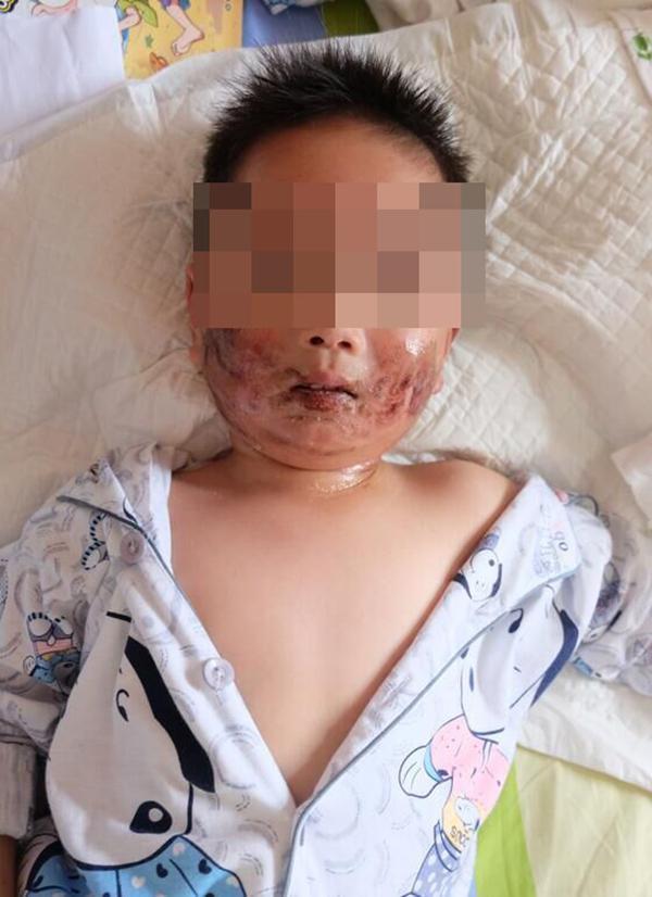 抱娃坐副驾驶 气囊弹出孩子脸变形