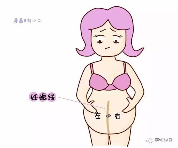 掌握了它, 也有长歪的, 像这样: 这条线有自己的名字, 它叫妊娠线!