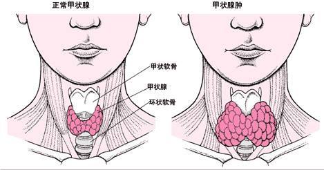 女人甲状腺位置图片图片