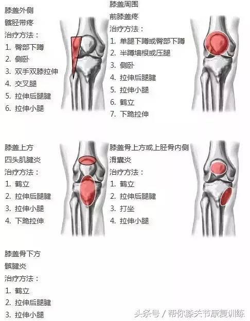 膝盖不同位置的疼痛代表不同疾病 你造吗 健康频道 手机搜狐