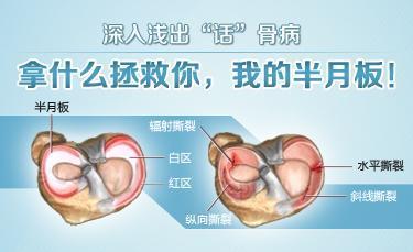 半月板损伤有什么危害怎么治疗 健康频道 手机搜狐
