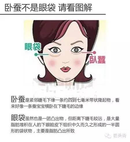 眼袋 卧蚕 泪沟的区别 眼袋的危害有哪些 有图有真相 时尚频道 手机搜狐