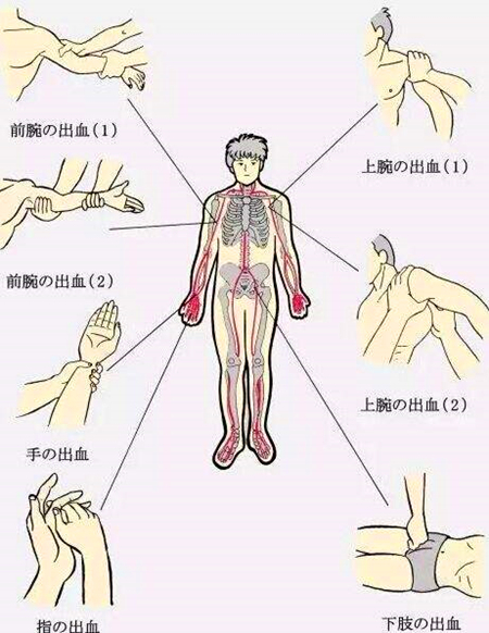 人工意外险 意外险怎么买