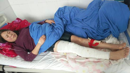 其中一辆货车副驾驶人员腿部骨折,事故发生后,项城交通运输局路政执法