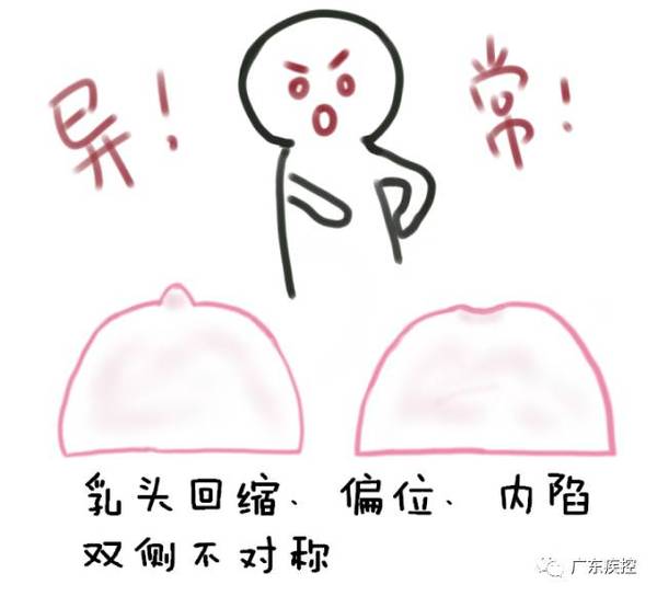 五种典型症状预告乳腺癌