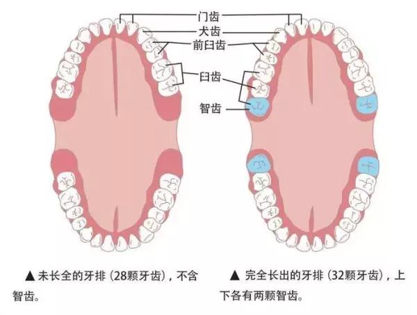 长智齿可以不拔吗 其实是可以的 健康频道 手机搜狐