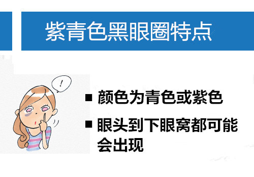 黑眼圈分类大起底 黑色 茶色 青紫色你是哪种 时尚频道 手机搜狐