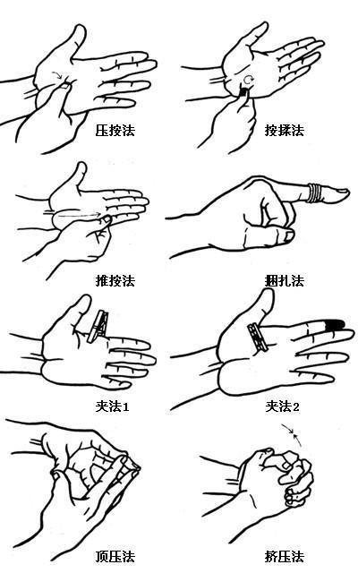 严重期:严重时关节绞锁在屈曲或伸直位,关节不能伸直或屈曲.