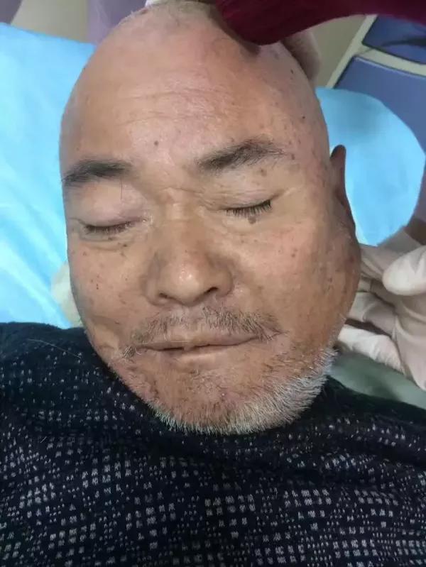 吉林永吉县医院,急寻病人家属,患者病情严重!