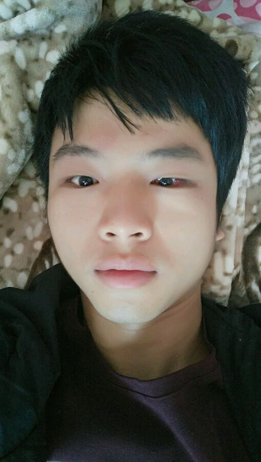 佛山华厦眼科医院,林小铭教授做的,好像是两条眼肌费用七千多吧.