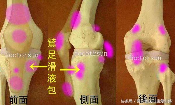 引起膝盖疼痛的六大原因 你中枪了吗 健康频道 手机搜狐