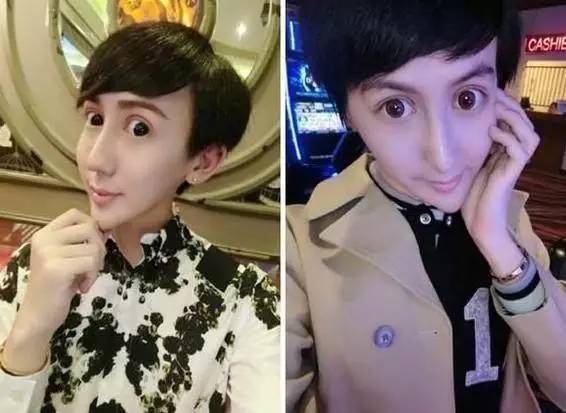 天天说郑爽整容 吴亦凡整容前土到爆 男星整容更猛 娱乐频道 手机搜狐