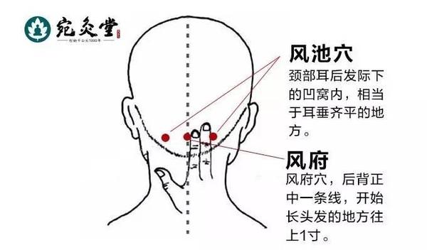 风池的准确位置定位图片