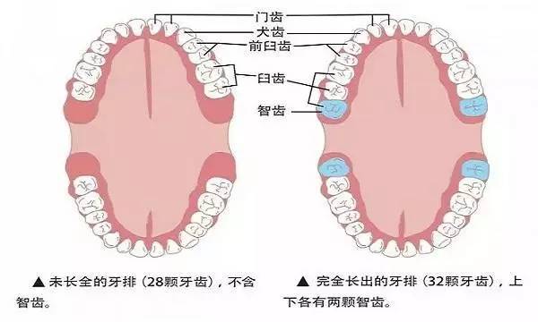 拔掉智齿会变笨 关于拔智齿 你究竟了解多少 时尚频道 手机搜狐