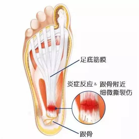 头条文章