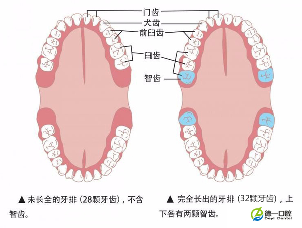 智齿牙龈肿痛怎么办 智齿是拔还是留 健康频道 手机搜狐