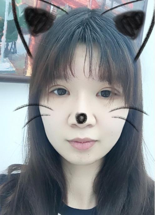 双眼皮第十天啦,告别之前的无力小眼睛