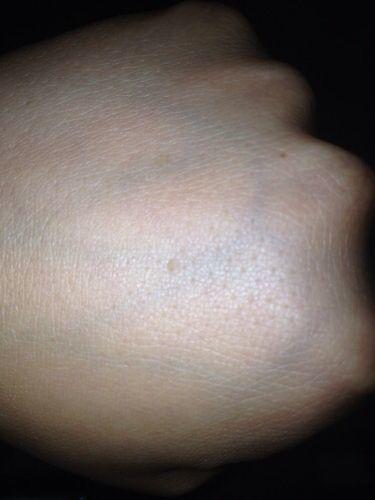 3,如果手背静脉突出,并且伴随着年龄增加越加明显,可能心脏方面有些