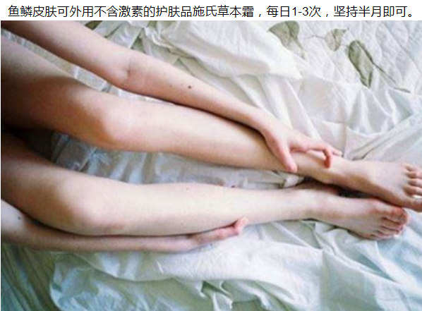 小腿鱼鳞病怎么办 清楚原因有效防御 健康频道 手机搜狐