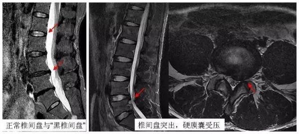 颈椎 腰腿痛应该做那些检查不花冤枉钱 答案在这 健康频道 手机搜狐