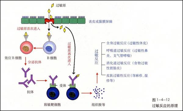 婴幼儿过敏性疾病的流行病学及防治策略 健康频道 手机搜狐