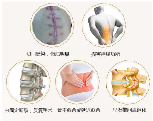 你信吗 不用手术一双手就能让你脊柱侧弯变 直 健康频道 手机搜狐